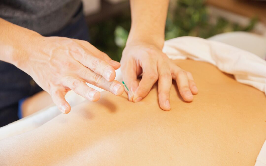 You don’t need to do talk therapy to treat trauma as an acupuncturist. Here’s why Use a bodywork-based approach to decrease your stress and be more effective